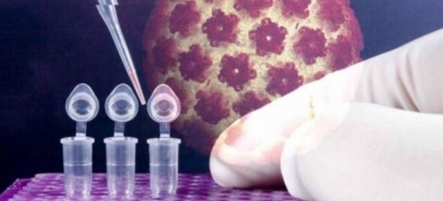 Diagnostika HPV z digene testom