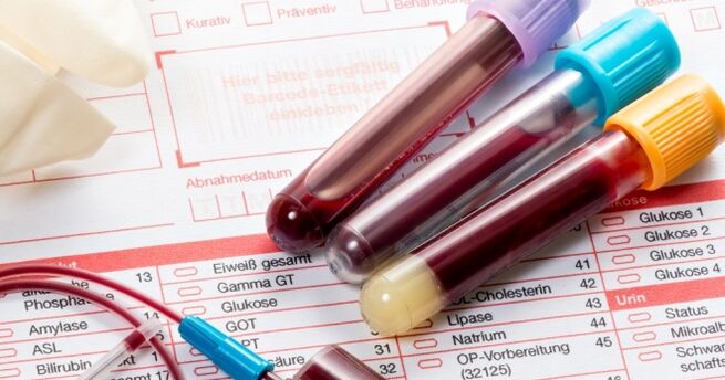 Krvni test za humani papiloma virus
