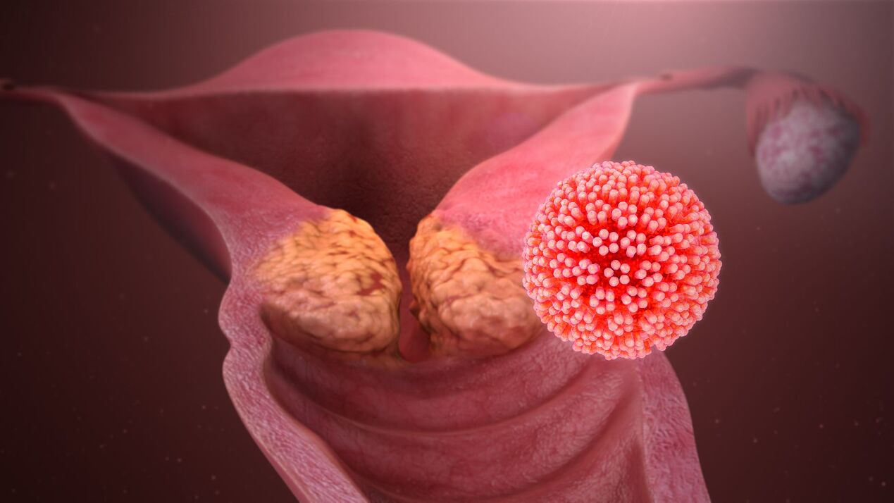 humani papiloma virus v telesu